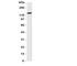 Solute Carrier Family 12 Member 2 antibody, R31290, NSJ Bioreagents, Western Blot image 