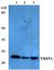 Troponin T1, Slow Skeletal Type antibody, A05799T1, Boster Biological Technology, Western Blot image 