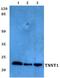 sTnT antibody, A05799T1, Boster Biological Technology, Western Blot image 