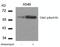 Checkpoint Kinase 2 antibody, 79-460, ProSci, Western Blot image 