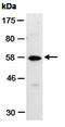 Matrix Metallopeptidase 20 antibody, orb67268, Biorbyt, Western Blot image 