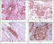 Ras-related protein Rab-25 antibody, STJ98347, St John