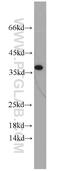 Insulin Like Growth Factor Binding Protein 3 antibody, 10189-2-AP, Proteintech Group, Western Blot image 