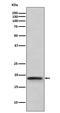 Lymphotoxin Alpha antibody, M00746-2, Boster Biological Technology, Western Blot image 