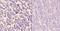 Interferon Regulatory Factor 4 antibody, GTX66692, GeneTex, Immunohistochemistry paraffin image 