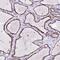 BTB Domain Containing 16 antibody, PA5-59208, Invitrogen Antibodies, Immunohistochemistry paraffin image 