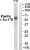 Paxillin antibody, abx012654, Abbexa, Western Blot image 