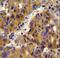 Branched Chain Keto Acid Dehydrogenase E1 Subunit Beta antibody, LS-C156767, Lifespan Biosciences, Immunohistochemistry paraffin image 