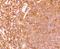 ETS Proto-Oncogene 1, Transcription Factor antibody, A00931-4, Boster Biological Technology, Immunohistochemistry paraffin image 
