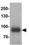 Interleukin 17 Receptor E antibody, GTX32106, GeneTex, Western Blot image 