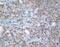 O-6-Methylguanine-DNA Methyltransferase antibody, 35-7000, Invitrogen Antibodies, Immunohistochemistry paraffin image 