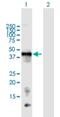 Chondromodulin antibody, H00011061-B01P, Novus Biologicals, Western Blot image 