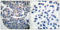 Eukaryotic Elongation Factor 2 Kinase antibody, A02277S366-2, Boster Biological Technology, Immunohistochemistry frozen image 
