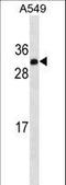 Insulin Like Growth Factor 2 antibody, LS-C159890, Lifespan Biosciences, Western Blot image 