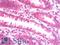 HIF-2-alpha antibody, LS-B10429, Lifespan Biosciences, Immunohistochemistry paraffin image 