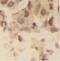 Ubiquitin carboxyl-terminal hydrolase 28 antibody, FNab09322, FineTest, Immunohistochemistry paraffin image 