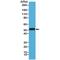 Keratin 14 antibody, M01432-3, Boster Biological Technology, Western Blot image 