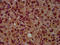 G Protein Subunit Alpha L antibody, LS-C680536, Lifespan Biosciences, Immunohistochemistry paraffin image 