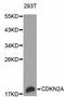 Cyclin-dependent kinase inhibitor 2A, isoforms 1/2/3 antibody, abx125659, Abbexa, Western Blot image 