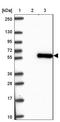 SMAD Family Member 5 antibody, NBP2-32406, Novus Biologicals, Western Blot image 