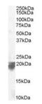 VPS29 Retromer Complex Component antibody, orb18650, Biorbyt, Western Blot image 