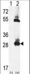 Thiamin pyrophosphokinase 1 antibody, LS-C160140, Lifespan Biosciences, Western Blot image 