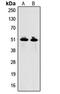 Growth Differentiation Factor 9 antibody, LS-C358994, Lifespan Biosciences, Western Blot image 