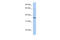 LFNG O-Fucosylpeptide 3-Beta-N-Acetylglucosaminyltransferase antibody, 26-024, ProSci, Western Blot image 