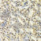 Deoxycytidine Kinase antibody, A1794, ABclonal Technology, Immunohistochemistry paraffin image 