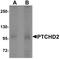 Dispatched RND Transporter Family Member 3 antibody, A11929-1, Boster Biological Technology, Western Blot image 