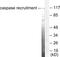 Caspase Recruitment Domain Family Member 6 antibody, LS-C118397, Lifespan Biosciences, Western Blot image 