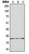 Rho GDP Dissociation Inhibitor Gamma antibody, LS-C351840, Lifespan Biosciences, Western Blot image 