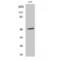 Arrestin Beta 1 antibody, LS-C382148, Lifespan Biosciences, Western Blot image 