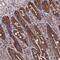 Deoxythymidylate Kinase antibody, NBP1-91851, Novus Biologicals, Immunohistochemistry frozen image 