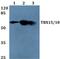 T-Box 15 antibody, PA5-36143, Invitrogen Antibodies, Western Blot image 