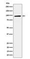 TGF-Beta Activated Kinase 1 (MAP3K7) Binding Protein 3 antibody, M05084, Boster Biological Technology, Western Blot image 