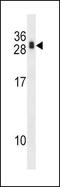 CSP1 antibody, PA5-35180, Invitrogen Antibodies, Western Blot image 