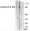 N-6 Adenine-Specific DNA Methyltransferase 1 antibody, orb341253, Biorbyt, Western Blot image 