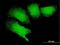 MAGE Family Member B18 antibody, H00286514-B01P, Novus Biologicals, Immunocytochemistry image 