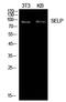 Selectin P antibody, STJ97288, St John