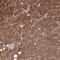 Homogentisate 1,2-Dioxygenase antibody, NBP2-49039, Novus Biologicals, Immunohistochemistry frozen image 