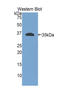 Integrin Subunit Beta 4 antibody, LS-C294701, Lifespan Biosciences, Western Blot image 