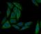 MAP/microtubule affinity-regulating kinase 3 antibody, NBP2-76884, Novus Biologicals, Immunocytochemistry image 