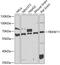 F-Box And WD Repeat Domain Containing 11 antibody, 23-181, ProSci, Western Blot image 