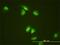 Stem-Loop Binding Protein antibody, H00007884-M01, Novus Biologicals, Immunocytochemistry image 