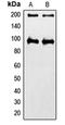 Insulin Like Growth Factor 1 Receptor antibody, orb214086, Biorbyt, Western Blot image 