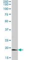 Adenine Phosphoribosyltransferase antibody, H00000353-B01P, Novus Biologicals, Western Blot image 