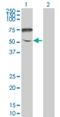 Ectonucleotide Pyrophosphatase/Phosphodiesterase Family Member 5 antibody, H00059084-M01, Novus Biologicals, Western Blot image 
