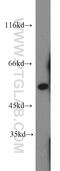Aldehyde Dehydrogenase 7 Family Member A1 antibody, 10368-1-AP, Proteintech Group, Western Blot image 