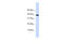 Chondromodulin antibody, 25-986, ProSci, Western Blot image 